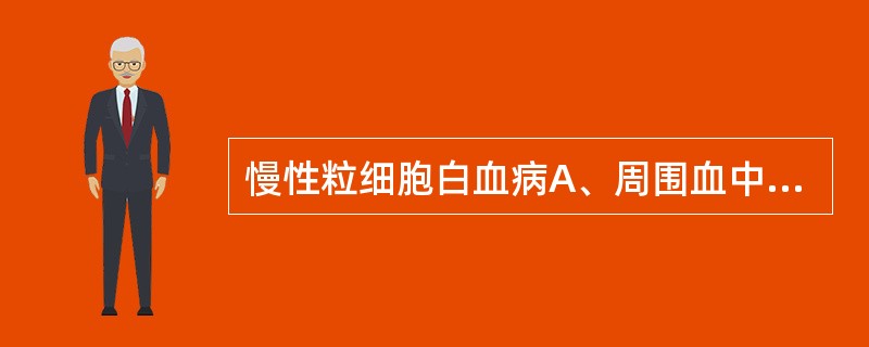 慢性粒细胞白血病A、周围血中幼稚细胞、原始细胞>30%B、周围血有较多幼稚粒细胞