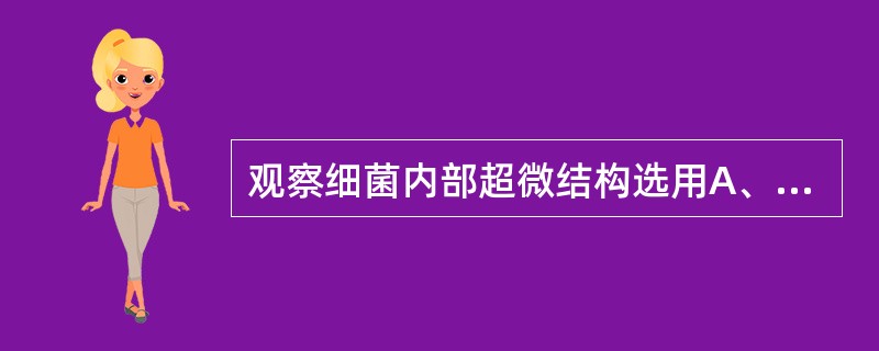 观察细菌内部超微结构选用A、相差显微镜B、电子显微镜C、荧光显微镜D、暗视野显微