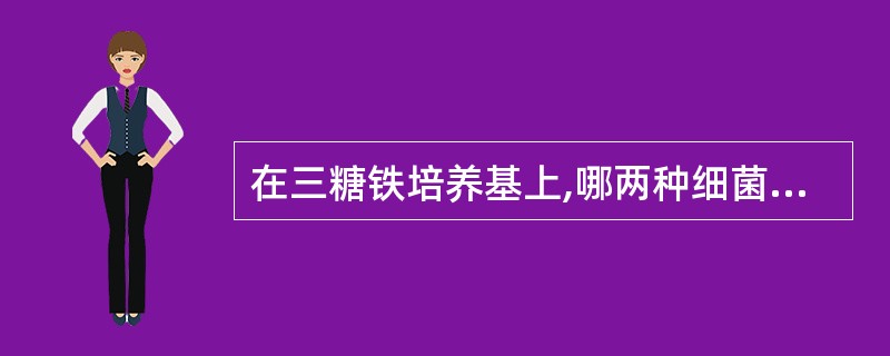 在三糖铁培养基上,哪两种细菌表现相似( )A、伤寒沙门菌与痢疾志贺菌B、大肠埃希