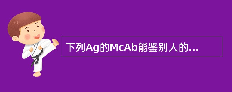 下列Ag的McAb能鉴别人的Ts细胞的是A、CD4B、CD8C、CD21D、CD