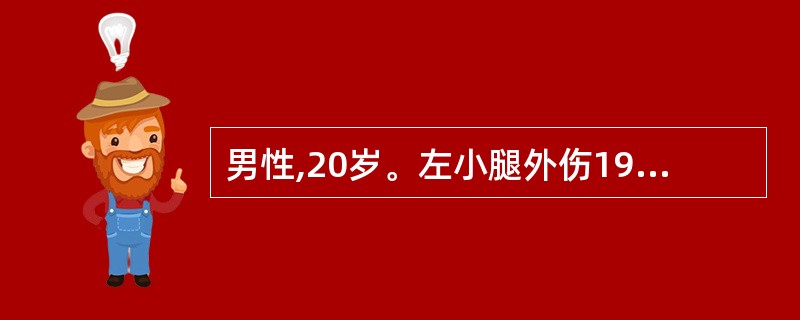 男性,20岁。左小腿外伤19小时就诊,查体:左小腿畸形,假关节活动,骨摩擦感,胫