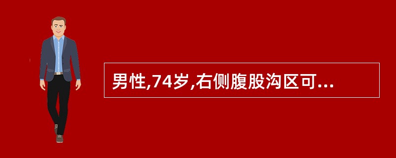 男性,74岁,右侧腹股沟区可复性肿块8年,查体:病人直立时,在腹股沟内侧端、耻骨