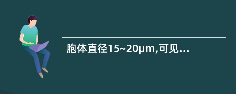 胞体直径15~20μm,可见伪足突出,核染色质粗粒状,不均匀,着色深,可有1~3