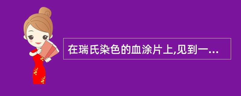 在瑞氏染色的血涂片上,见到一个细胞呈圆形,直径10~14μm,胞核分叶不清楚,胞