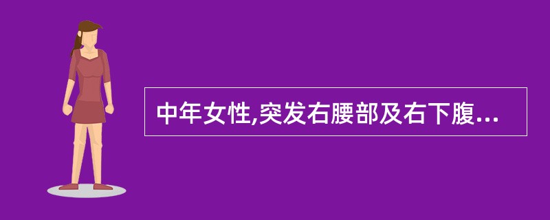 中年女性,突发右腰部及右下腹部剧痛,伴恶心。超声显示右肾轻度积水,最可能的诊断是