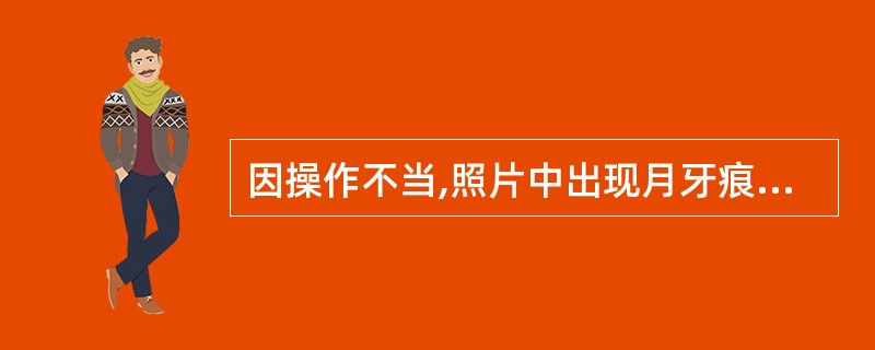 因操作不当,照片中出现月牙痕伪影,产生的原因是胶片的