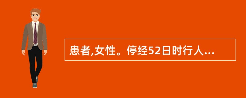 患者,女性。停经52日时行人工流产术,术后半月出现阴道流血,量时多时少,查子宫如