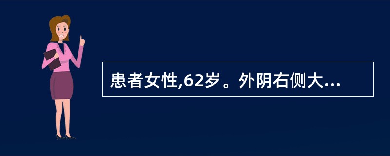 患者女性,62岁。外阴右侧大阴唇鳞状细胞癌,局限于外阴,肿瘤直径2cm,浸润深度