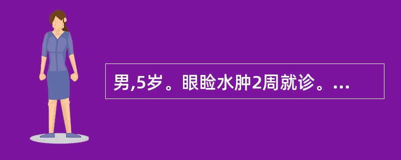 男,5岁。眼睑水肿2周就诊。查体:Hb97g£¯L,尿蛋白(£«£«),尿红细胞
