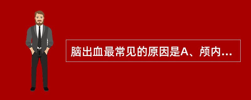 脑出血最常见的原因是A、颅内肿瘤破裂B、颅内动脉瘤破裂C、高血压脑动脉硬化D、动