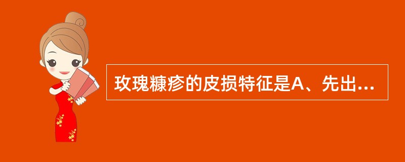 玫瑰糠疹的皮损特征是A、先出现母斑,后出现子斑B、皮损呈向心性分布C、皮损长轴与