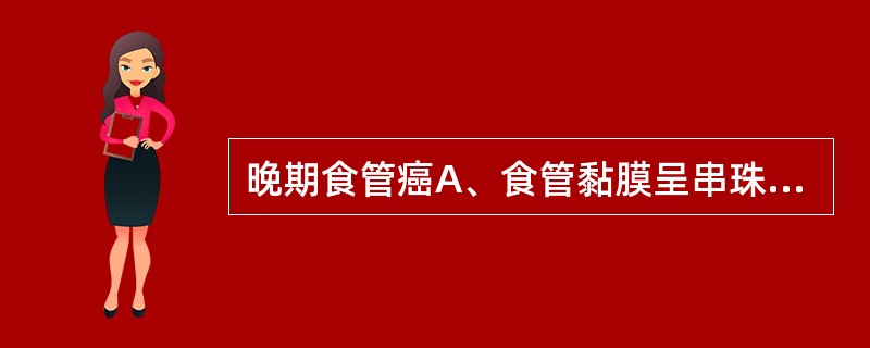 晚期食管癌A、食管黏膜呈串珠样改变,食管蠕动良好B、充盈缺损,管腔狭窄梗阻C、食