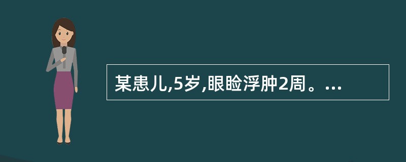 某患儿,5岁,眼睑浮肿2周。化验检查:血红蛋白97g£¯L,尿蛋白£«£¯HP,