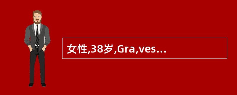 女性,38岁,Gra,ves病甲状腺次全切除术后10年。近4个月心慌、怕热、多汗