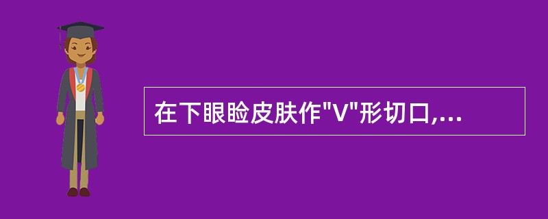 在下眼睑皮肤作"V"形切口,然后将其缝成"Y"形用以治疗( )A、眼睑内翻B、麦