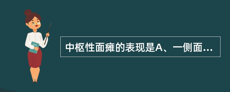 中枢性面瘫的表现是A、一侧面瘫£«味觉丧失B、睑裂以下表情肌瘫痪C、单纯一侧完全