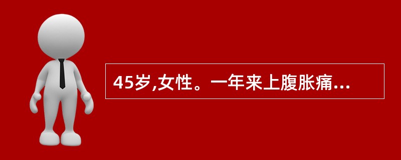 45岁,女性。一年来上腹胀痛,无规律性,并有厌食,体重减轻约10公斤,近2天呕黯