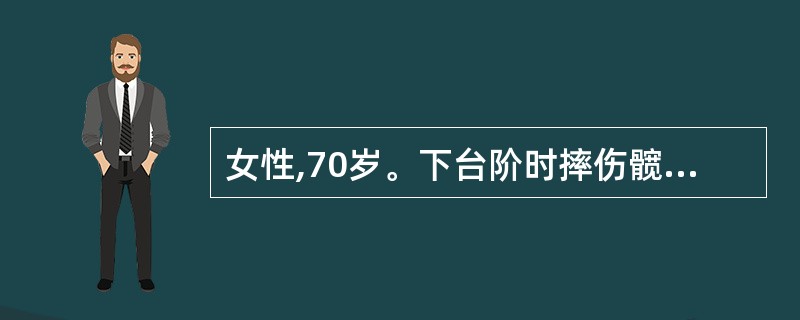 女性,70岁。下台阶时摔伤髋部。查体右下肢短缩3Cm,足外旋45°,髋部叩压痛明