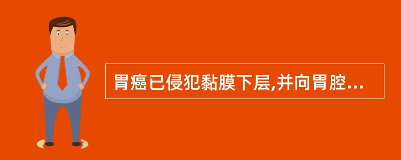 胃癌已侵犯黏膜下层,并向胃腔突出,高于黏膜表面8cm应属A、早期隆起型胃癌B、早