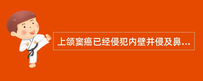 上颌窦癌已经侵犯内壁并侵及鼻腔,其照射范围一般不包括以下哪项A、上颌窦B、鼻腔C