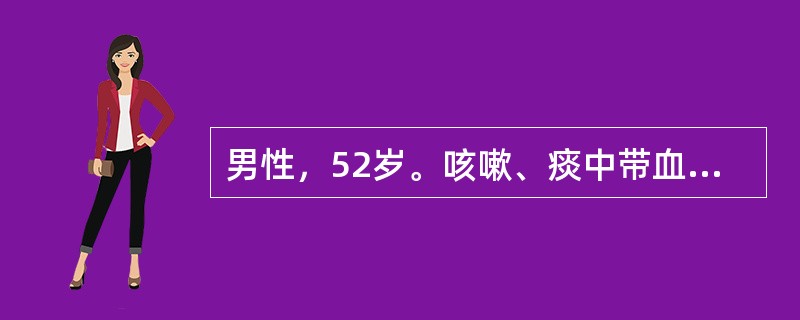 男性，52岁。咳嗽、痰中带血1个月。1月前因受凉后出现咳嗽、咳痰症状，痰为白色泡