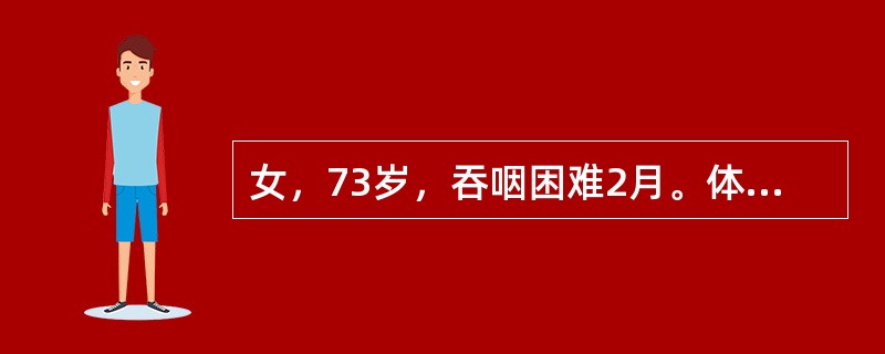 女，73岁，吞咽困难2月。体检：咽充血，滤泡增生，最可能的诊断为()