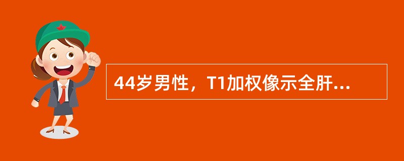 44岁男性，T1加权像示全肝均匀分布直径0.5～1.0cm略高信号小结节影，T2