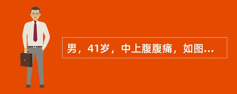 男，41岁，中上腹腹痛，如图所示，最可能的诊断是()