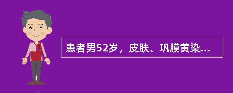 患者男52岁，皮肤、巩膜黄染进行性加重，上腹部胀痛不适1个月余，B超检查，胰管扩