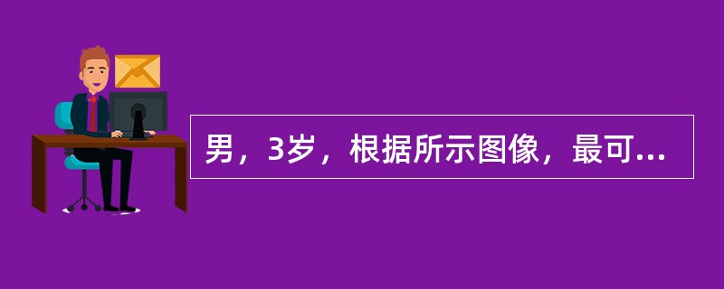 男，3岁，根据所示图像，最可能的诊断()