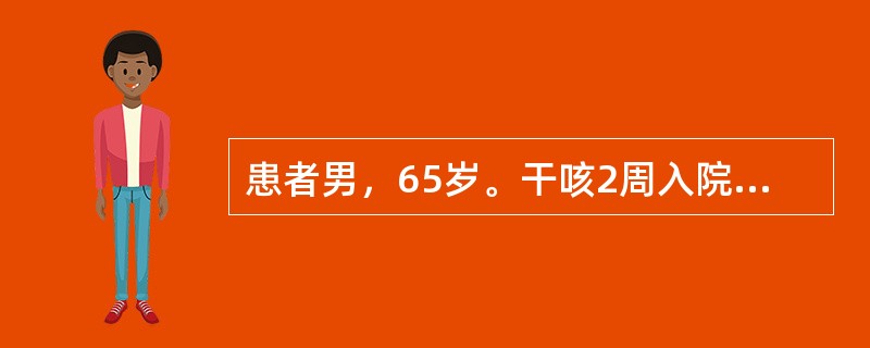 患者男，65岁。干咳2周入院，无发热、咯血及呼吸困难。查体：心肺未见异常，双手可