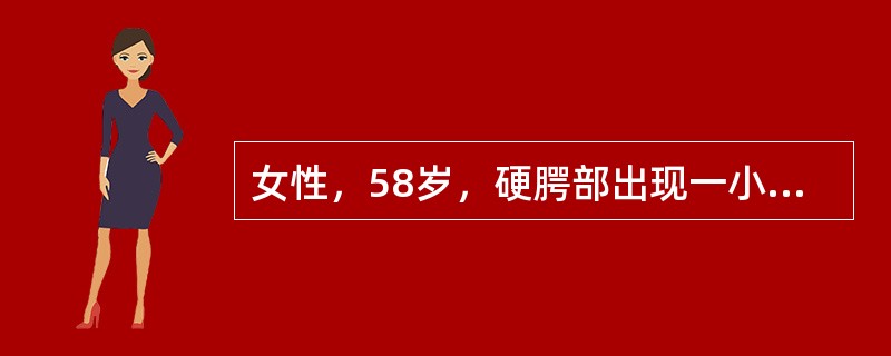 女性，58岁，硬腭部出现一小的包块，约1cm，偶有轻微不适。镜下可见肿瘤细胞排列