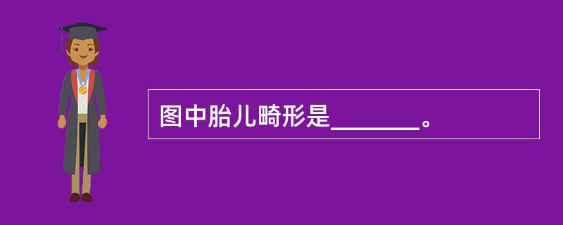 图中胎儿畸形是_______。