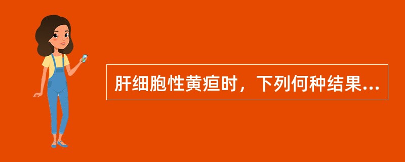 肝细胞性黄疸时，下列何种结果是正确的（）。