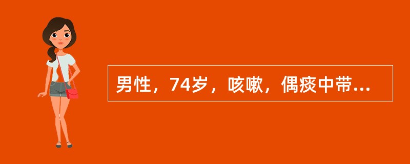 男性，74岁，咳嗽，偶痰中带血，胸痛近两个月，后前位示左肺门肿块影约3cm大小，