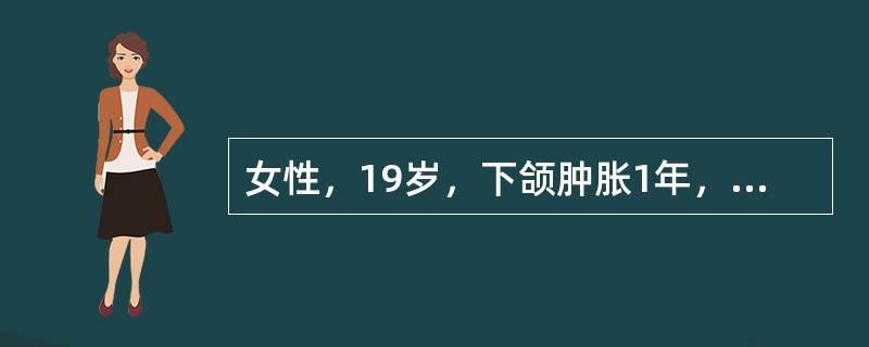 女性，19岁，下颌肿胀1年，X光见病变区呈毛玻璃状，边界不清。镜下见正常的骨结构