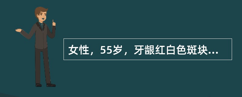 女性，55岁，牙龈红白色斑块半年不消失，擦不掉。镜下见上皮分层消失，病变细胞充满