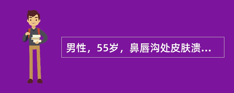 男性，55岁，鼻唇沟处皮肤溃疡1年余不愈。溃疡似鼠咬状，边缘硬。镜下见肿瘤呈浸润