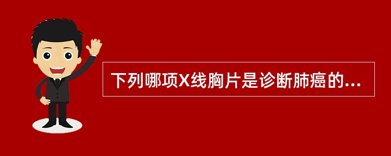 下列哪项X线胸片是诊断肺癌的基本手段，诊断阳性率为56%～100%（）