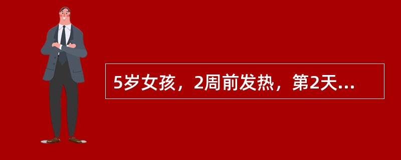 5岁女孩，2周前发热，第2天后出皮疹，皮疹2～3天出齐后体温渐退，1周来全身皮肤