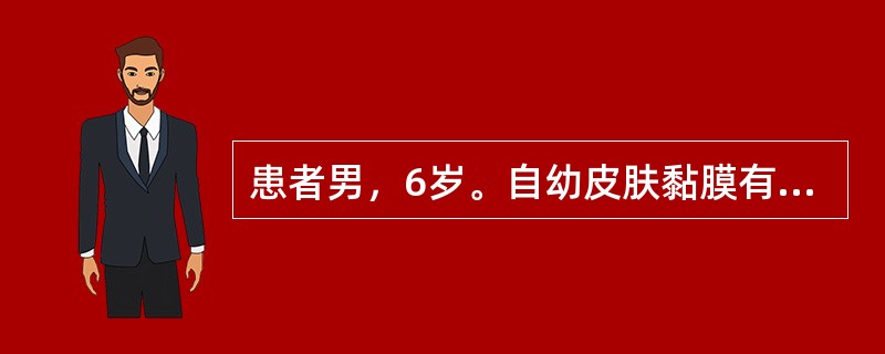 患者男，6岁。自幼皮肤黏膜有出血症状，血小板计数120×10/L，血涂片可见血小