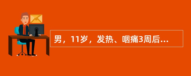 男，11岁，发热、咽痛3周后，水肿、少尿，红细胞15～20个／HP，尿蛋白（+）