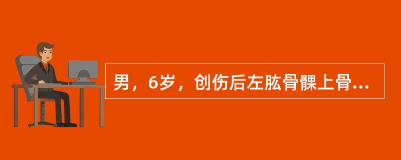 男，6岁，创伤后左肱骨髁上骨折，肿胀严重，经4次手法复法，骨折移位矫正才满意，可