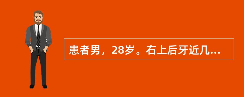 患者男，28岁。右上后牙近几日咬合痛，并有患牙发麻浮出感觉，咬紧患牙，疼痛可缓解