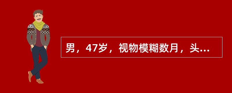 男，47岁，视物模糊数月，头痛、恶心、呕吐3天，行MRI检查如图，最可能的诊断为