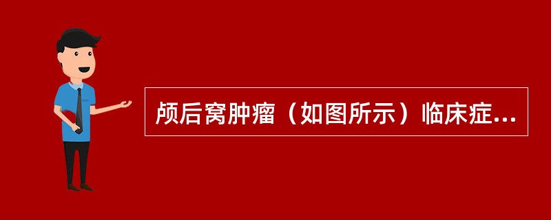 颅后窝肿瘤（如图所示）临床症状应除外（）