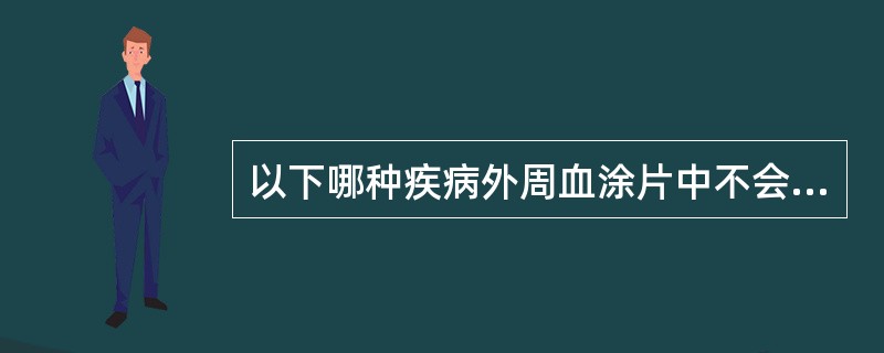 以下哪种疾病外周血涂片中不会出现幼稚血细胞（）