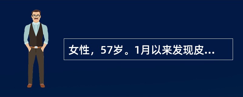 女性，57岁。1月以来发现皮肤、巩膜逐渐变黄，近1周更加明显。无腹痛、寒战、发热