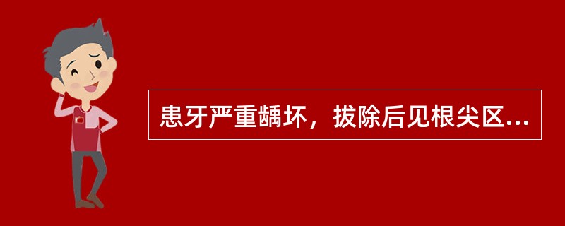 患牙严重龋坏，拔除后见根尖区附着一团组织（）