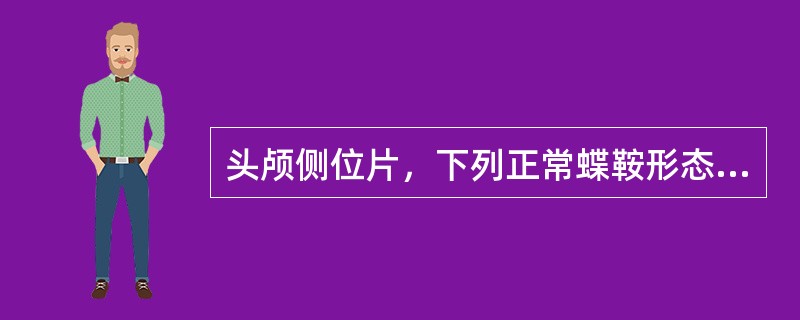 头颅侧位片，下列正常蝶鞍形态中，哪项不正确（）